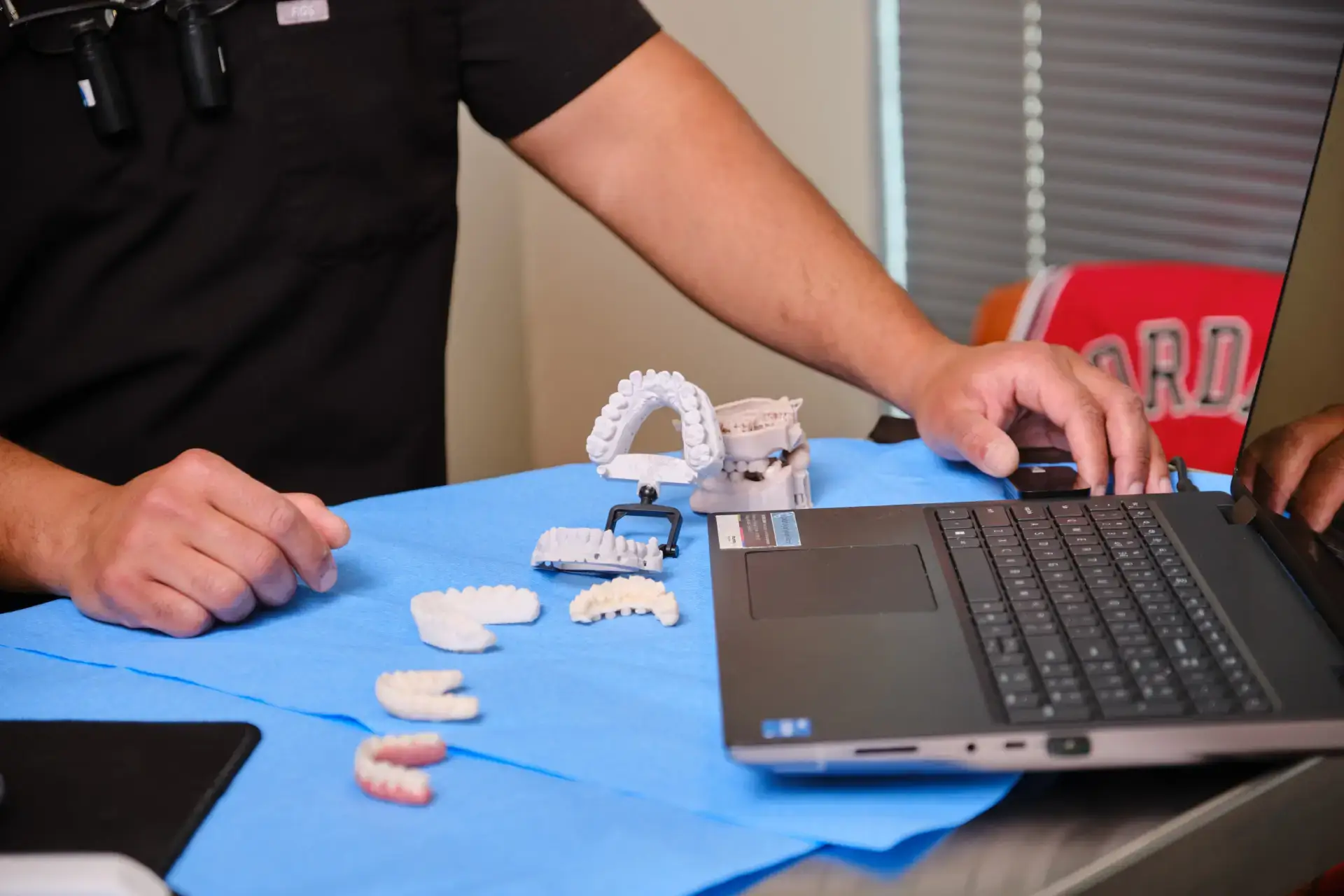 Dental Implants: The Modern Solution to Missing Teeth