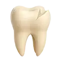 Cracked/chipped tooth repair