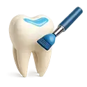 Tooth-colored fillings